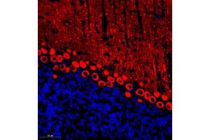 Immunofluorescent analysis of paraffin embedded mouse cerebellum using HOMER3 (ABIN7074257) at dilution of 1: 700