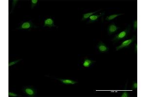 Immunofluorescence of monoclonal antibody to HNF4A on HeLa cell. (HNF4A antibody  (AA 324-423))