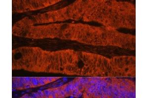 Immunofluorescence analysis of Human colon carcinoma using TLN1 Polyclonal Antibody at dilution of 1:100. (TLN1 antibody)