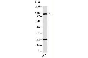 Western blot testing of mouse samples with TLR9 antibody at 2ug/ml. (TLR9 antibody  (N-Term))