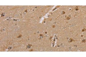 Immunohistochemistry of paraffin-embedded Human brain tissue using DLD Polyclonal Antibody at dilution 1:35 (DLD antibody)