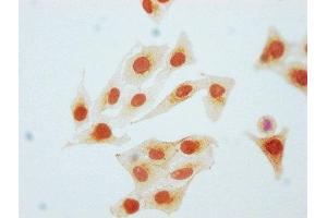 Immunocytochemistry analysis of ABIN7127684 diluted at 1:80 and staining in Hela cells(treated with Pervanadate) performed on a Leica BondTM system. (Recombinant CDK2 antibody  (pTyr15))