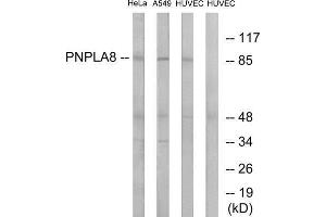 Western Blotting (WB) image for anti-Patatin-Like phospholipase Domain Containing 8 (PNPLA8) (C-Term) antibody (ABIN1850962) (PNPLA8 antibody  (C-Term))