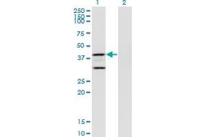 Western Blot analysis of PTGES2 expression in transfected 293T cell line by PTGES2 monoclonal antibody (M01), clone 5B7. (PTGES2 antibody  (AA 270-377))