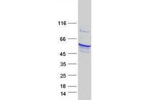 Validation with Western Blot