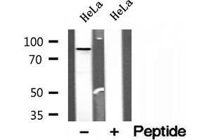 Western blot analysis of extracts of HeLa cells, using OSBP antibody.