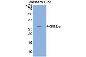 Detection of Recombinant MMP24, Human using Polyclonal Antibody to Matrix Metalloproteinase 24 (MMP24) (MMP24 antibody  (AA 429-642))