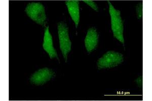 Immunofluorescence of monoclonal antibody to MTPN on HeLa cell. (MTPN antibody  (AA 1-118))