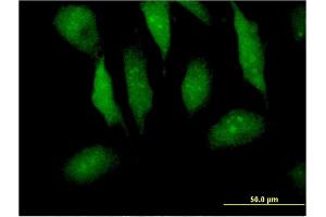 Immunofluorescence of monoclonal antibody to MTPN on HeLa cell. (MTPN antibody  (AA 1-118))