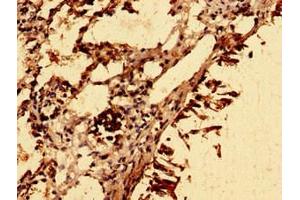 Immunohistochemistry of paraffin-embedded human lung tissue using ABIN7176714 at dilution of 1:100 (SLC39A8 antibody  (AA 30-132))