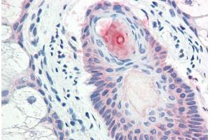 Anti-DHRS7 antibody  ABIN1048499 IHC staining of human skin, pilosebaceous unit. (DHRS7 antibody  (Internal Region))