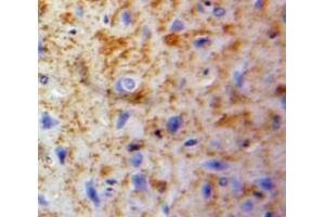IHC-P analysis of Brain tissue, with DAB staining.