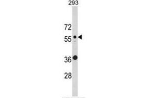 Western blot analysis of KRT10 Antibody (N-term) in 293 cell line lysates (35ug/lane). (Keratin 10 antibody  (N-Term))