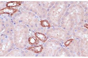 Immunohistochemistry of paraffin-embedded Rat kidney using UGT2B15 Polyclonal Antibody at dilution of 1:100 (40x lens). (UGT2B15 antibody)