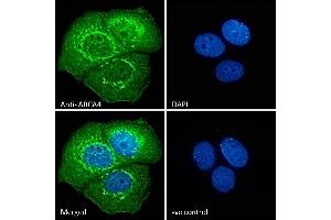 ABIN343052 Immunofluorescence analysis of paraformaldehyde fixed MCF7 cells, permeabilized with 0. (ABCA4 antibody  (AA 2250-2263))