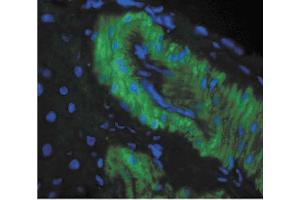 Immunohistochemistry analysis using Mouse Anti-Nitrotyrosine Monoclonal Antibody, Clone 39B6 . (Nitrotyrosine antibody  (PerCP))