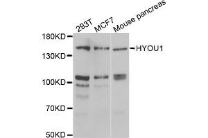 Western blot analysis of extracts of various cell lines, using HYOU1 antibody (ABIN2563312) at 1:1000 dilution. (HYOU1 antibody)