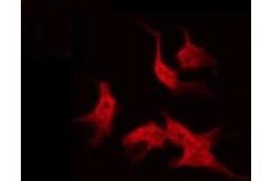 anti-ATP-Binding Cassette, Sub-Family C (CFTR/MRP), Member 13, Pseudogene (ABCC13) antibody