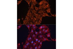 Immunofluorescence analysis of C6 cells using  antibody (ABIN6131156, ABIN6136521, ABIN6136522 and ABIN6223942) at dilution of 1:100. (ADAM12 antibody  (AA 589-738))