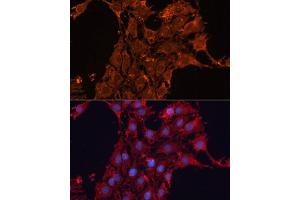 Immunofluorescence analysis of C6 cells using  antibody (ABIN6131156, ABIN6136521, ABIN6136522 and ABIN6223942) at dilution of 1:100.