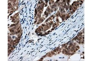 Immunohistochemical staining of paraffin-embedded Kidney tissue using anti-FAHD2A mouse monoclonal antibody.