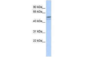 WB Suggested Anti-DMRTA1 Antibody Titration: 0. (DMRTA1 antibody  (Middle Region))