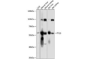 Western blot analysis of extracts of various cell lines, using FTCD antibody (ABIN6133518, ABIN6140789, ABIN6140790 and ABIN6225015) at 1:1000 dilution. (FTCD antibody  (AA 412-541))