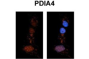 Immunohistochemistry with Rat Brain lysate tissue (PDIA4 antibody  (N-Term))