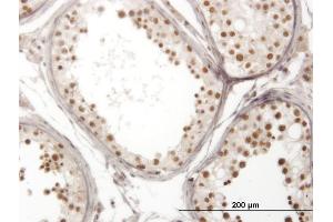 Immunoperoxidase of monoclonal antibody to NOL4 on formalin-fixed paraffin-embedded human testis. (NOL4 antibody  (AA 425-524))