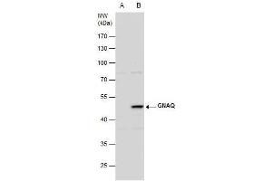 Western Blotting (WB) image for anti-Guanine Nucleotide Binding Protein (G Protein), Q Polypeptide (GNAQ) (Center) antibody (ABIN2855848)