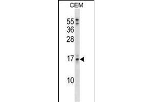 SOSTDC1 Antibody (C-term) (ABIN1536776 and ABIN2849017) western blot analysis in CEM cell line lysates (35 μg/lane). (SOSTDC1 antibody  (C-Term))