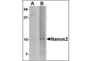 Western blot analysis of Nanos2 in rat brain tissue lysate with this product at (A) 1 and (B) 2 μg/ml.