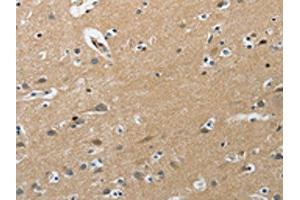 The image on the left is immunohistochemistry of paraffin-embedded Human brain tissue using ABIN7191891(PIP5K1C Antibody) at dilution 1/25, on the right is treated with synthetic peptide.