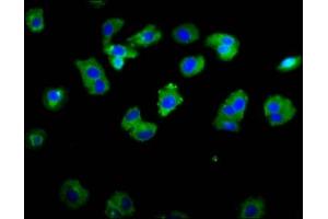 Immunofluorescence staining of HepG2 cells with ABIN7142996 at 1:133, counter-stained with DAPI. (ASIC1 antibody  (AA 195-297))