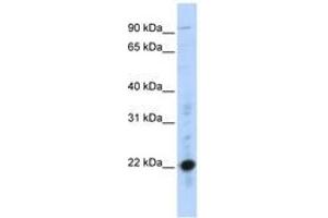 Image no. 1 for anti-Cysteine-Rich Protein 2 (CRIP2) (C-Term) antibody (ABIN6740380) (CRIP2 antibody  (C-Term))