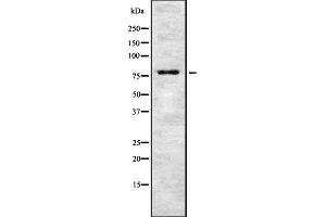 Western blot analysis of TSYL2 expression in HEK293 cells ,The lane on the left is treated with the antigen-specific peptide. (TSPY-Like 2 antibody  (Internal Region))