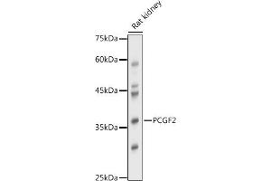 Western blot analysis of extracts of Rat kidney, using PCGF2 antibody (ABIN7269450) at 1:1000 dilution. (PCGF2 antibody)