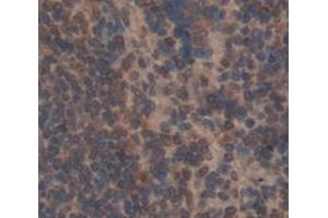 Figure. (PRDM1 antibody  (AA 541-815))