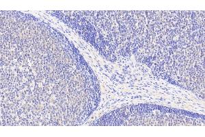 Detection of ACAT1 in Human Lymph node Tissue using Polyclonal Antibody to Acetyl Coenzyme A Acetyltransferase 1 (ACAT1) (ACAT1 antibody  (AA 111-427))