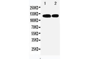 Anti-p107 antibody, Western blotting Lane 1: 239T Cell Lysate Lane 2: JURKAT Cell Lysate (p107 antibody  (C-Term))