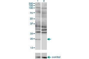 Western blot analysis of HAND2 over-expressed 293 cell line, cotransfected with HAND2 Validated Chimera RNAi (Lane 2) or non-transfected control (Lane 1). (HAND2 antibody  (AA 135-216))