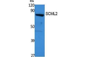 Western Blotting (WB) image for anti-Sex Comb On Midleg-Like 2 (SCML2) (Internal Region) antibody (ABIN3178132) (SCML2 antibody  (Internal Region))