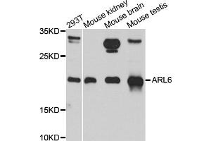 Western blot analysis of extracts of various cell lines, using ARL6 antibody (ABIN5974886) at 1/1000 dilution. (ARL6 antibody)