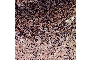 Immunohistochemical analysis of Telomerase staining in human spleen formalin fixed paraffin embedded tissue section.