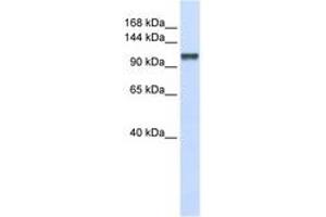 Image no. 1 for anti-Calcium Homeostasis Endoplasmic Reticulum Protein (CHERP) (C-Term) antibody (ABIN6740689)