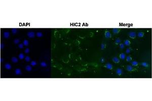 Immunofluorescent staining of Huh7 cell with HIC2 polyclonal antibody  under 4 ug/mL working concentration. (HIC2 antibody  (AA 395-444))