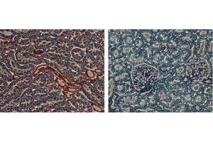 Expression of KCNJ1 in rat kidney - Immunohistochemical staining of rat kidney sections using Anti-KCNJ1 (Kir1. (KCNJ1 antibody  (C-Term, Intracellular))