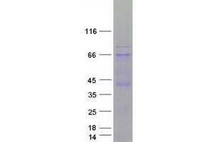 Validation with Western Blot