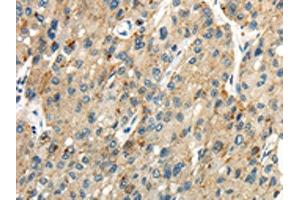 Claudin 19 antibody