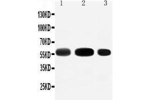 Anti-EAAT3 antibody, Western blotting Lane 1: Rat Liver Tissue Lysate Lane 2: Rat Heart Tissue Lysate Lane 3: HEPA Cell Lysate (SLC1A1 antibody  (N-Term))
